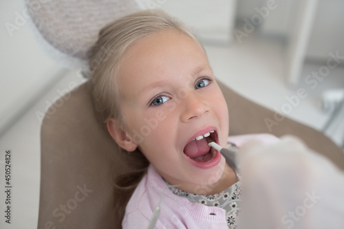 Little gir sitting with an open mouth at the dentists photo