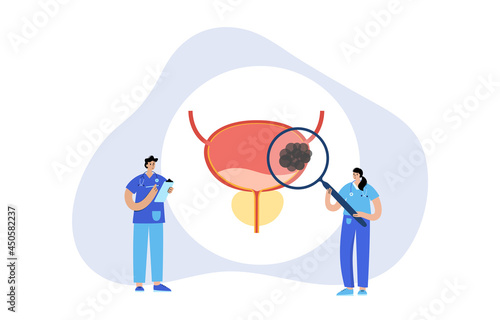 Bladder cancer stages