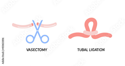 Vasectomy. Male or female sterilization concept. Tubal ligation colored flat style icon. Women or man surgical permanent birth control methods. Surgery procedure. Vector element isolated on white.