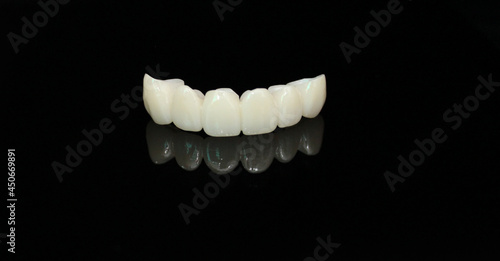 Long dental zirconia bridge with all porcelain baked photo