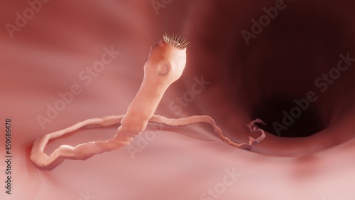 Fotografía Tapeworm in the intestine