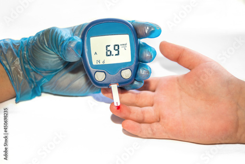 Measurement of blood sugar at home. A nurse measures the blood sugar of an 11 year old boy. The concept of diabetes. A blue-gloved hand. A little too high reading of blood sugar (6.7) Mmol/L Internati photo