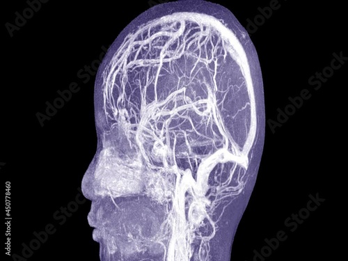 Magnetic resonance imaging mri of the human brain. Closeup. Medical technology concept.