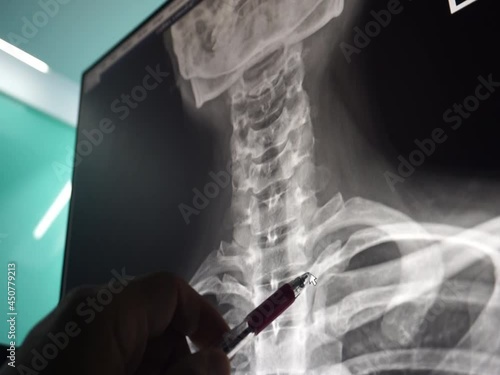 doctor looking at x-ray c-spine image