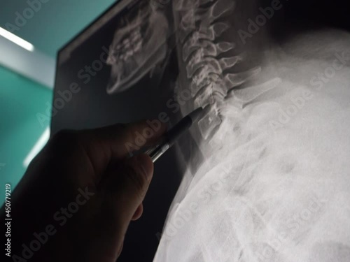 close up hand doctor point x-ray neck 