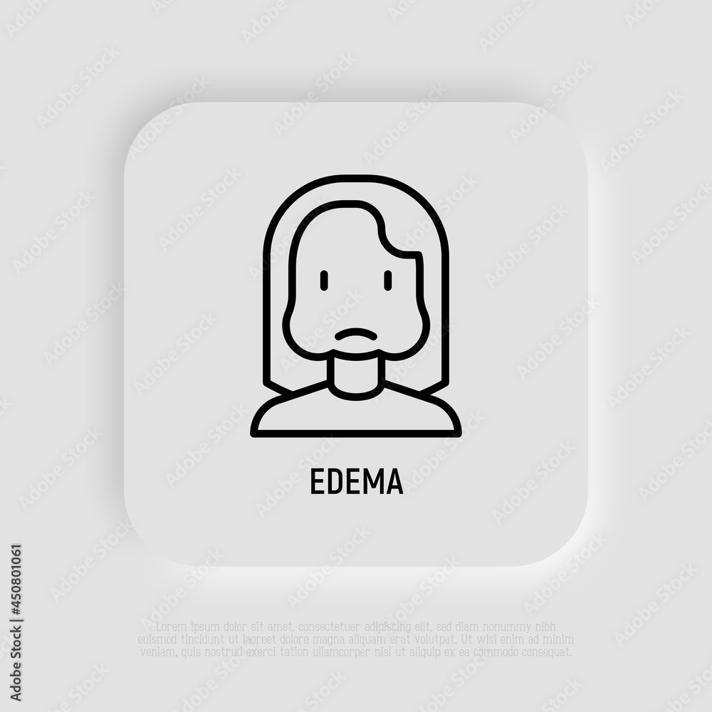 Edema thin line icon, woman with swollen cheeks. Allergy symptom. Modern vector illustration Edema thin line icon, woman with swollen cheeks. Allergy symptom. Modern vector illustration