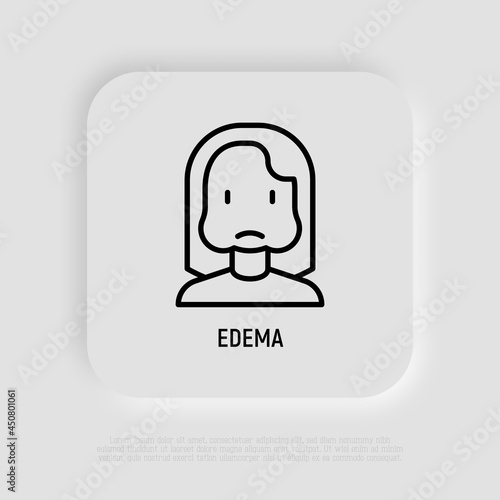 Edema thin line icon, woman with swollen cheeks. Allergy symptom. Modern vector illustration