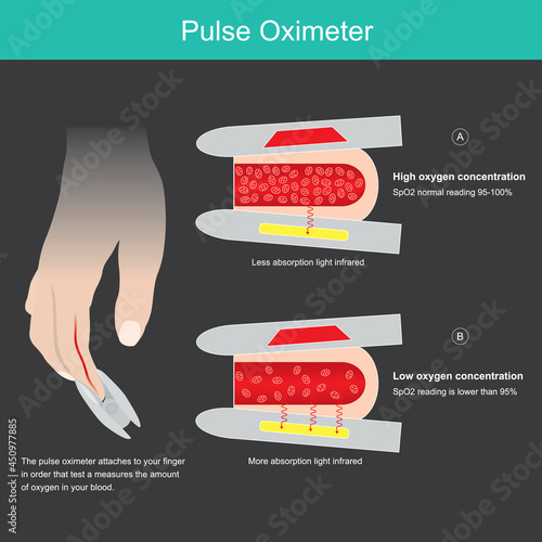 Pulse Oximeter. Illustration for learning medical device used to measuring oxygen saturation in blood vessel from tip finger..