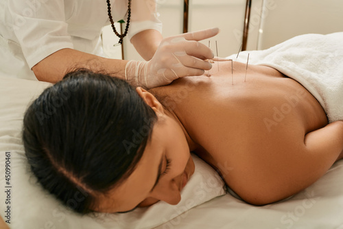 Εκτύπωση καμβά Adult woman relaxing and enjoying during acupuncture procedure
