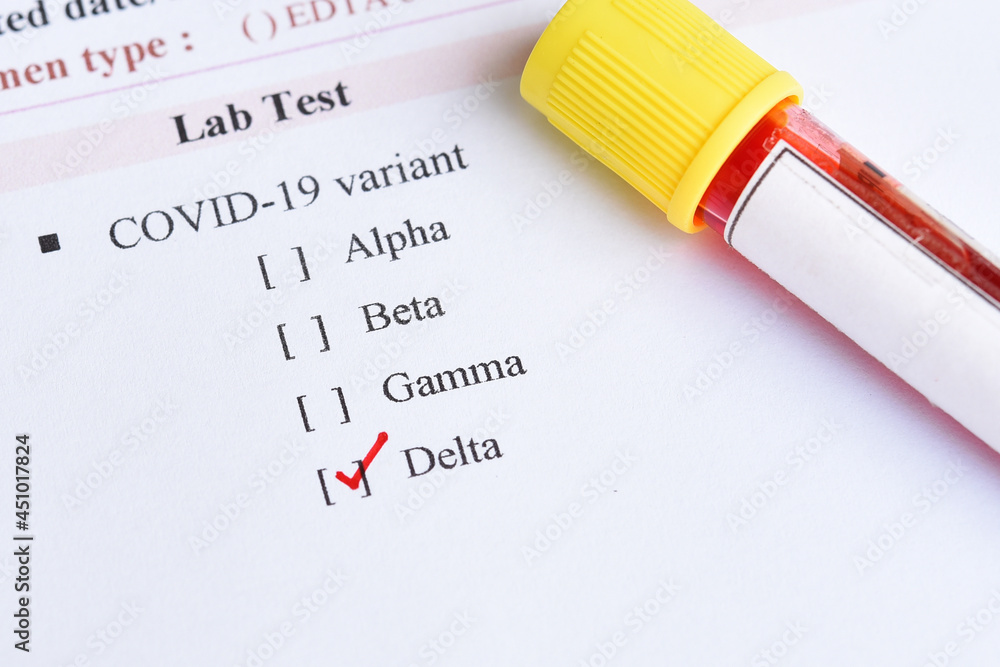 Delta variant COVID-19 positive, blood sample tube positive with delta variant or Indian strain COVID-19 Delta variant COVID-19 positive, blood sample tube positive with delta variant or Indian strain COVID-19
