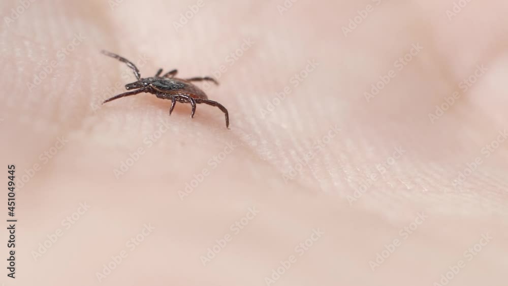 The mite crawls on human skin. Harvest-bug tries to bite a person. Small parasitic insects crawl along the human hand. Ticks carry encephalitis. Creeping blood-sucking mites on human skin The mite crawls on human skin. Harvest-bug tries to bite a person. Small parasitic insects crawl along the human hand. Ticks carry encephalitis. Creeping blood-sucking mites on human skin