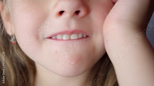 girl opens her mouth wide and pulls out long tongue. child shows his teeth soft palate and mouth to dentist. mouth is wide open, tongue is stuck out as far as possible, with clear view of tongue photo