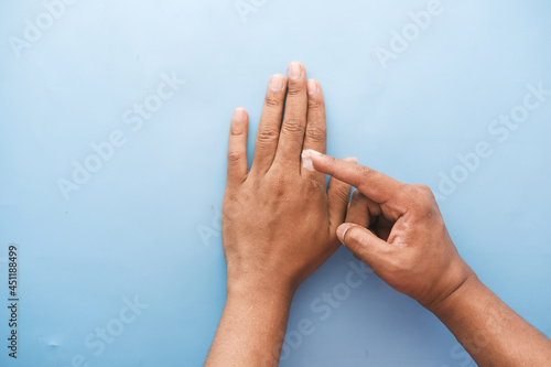  Close up of man hand applying petroleum jelly on hand on blue  photo