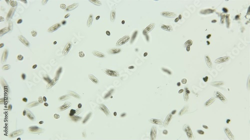 Infusorium colony Ciliophora Hypotrichia and Coleps under a microscope, Class Spirotrichea and Prostomatea. Planktonic organism. Move chaotically in a drop of water photo