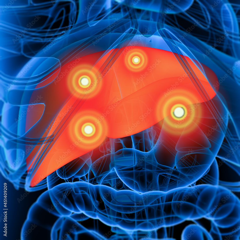 Anatomy of human liver in x-ray view Stock Illustration | Adobe Stock