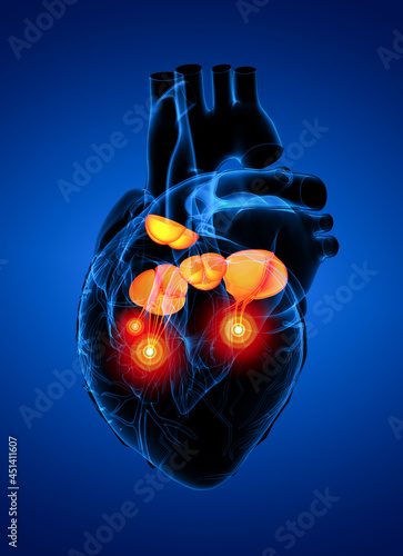 3d render Heart valve - side