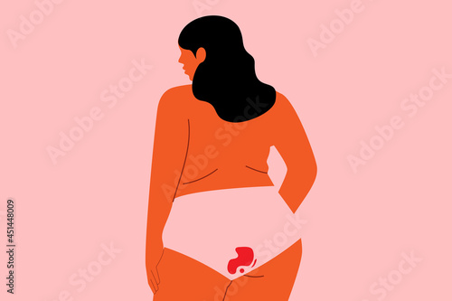 Normalizing menstruation. Concept on body positivity and period. Plus size woman in underwear with menstrual blood stain. Flat vector illustration isolated on pink background. Minimal character design photo