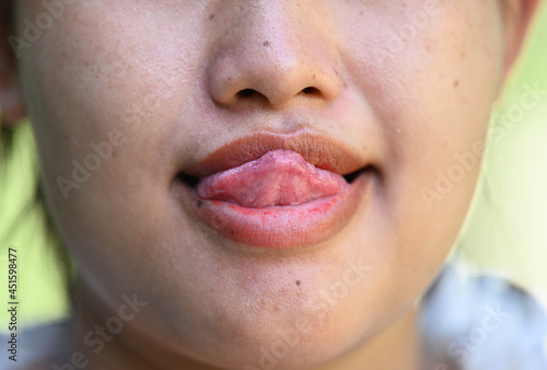 Close up of Asia woman with white teeth smiling and sticking.