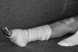 broken leg. bandaging foot