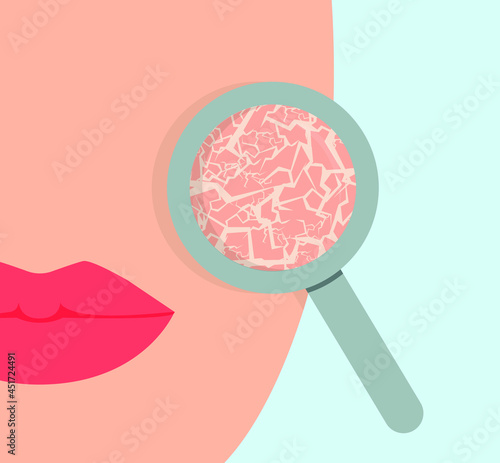 Dry skin of the girl's face through a magnifying glass. Concept: skin problems, care and cosmetics. Vector illustration, flat cartoon color minimal design, eps 10.