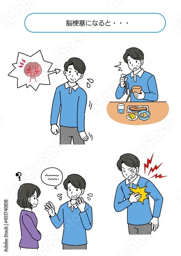 脳梗塞まとめイラスト