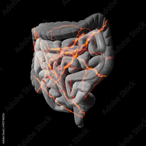 Intestinal pain, conceptual illustration photo