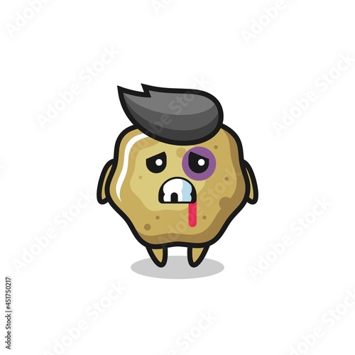 injured loose stools character with a bruised face