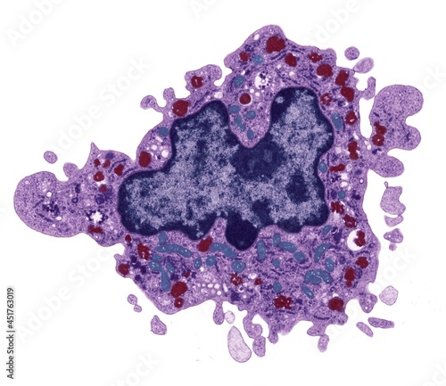 Macrophage, TEM photo