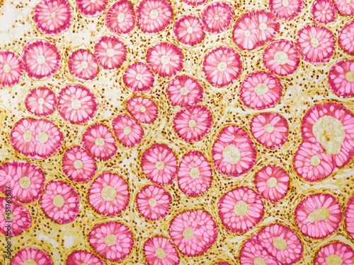 Crypts of Lieberkuhn, LM