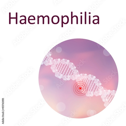Haemophilia, illustration photo