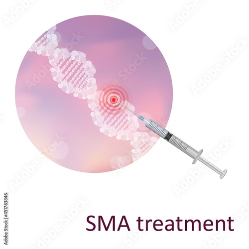 Spinal muscular atrophy treatment, illustration photo