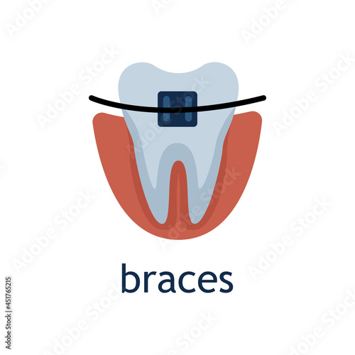 Vector flat illustration of a tooth with brace
