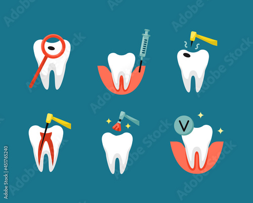 Vector set of flat dentistry icons. Pulpitis treatment