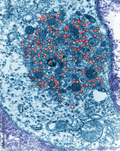 Mouse mammary tumour virus, TEM photo
