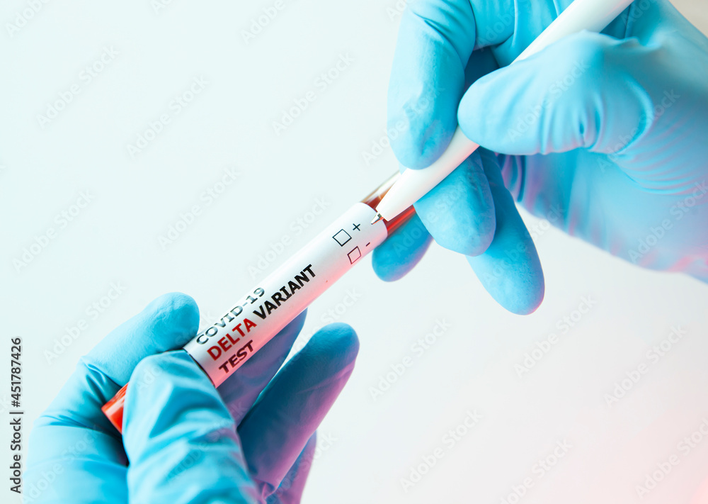 laboratory assistant marks a positive blood test by red check mark laboratory assistant marks a positive blood test by red check mark