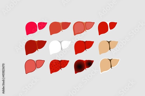 Human Heart symbols vector illustration. Different types of heart conditions. 