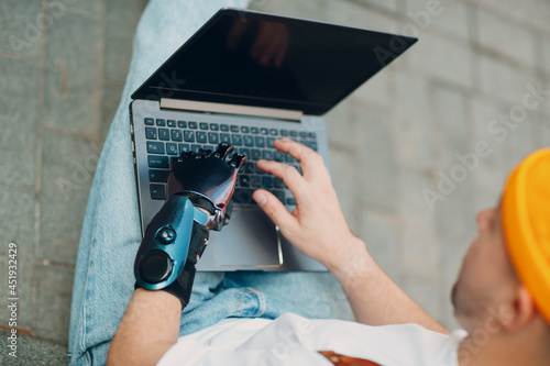 Young disabled man with artificial prosthetic hand using typing on laptop keys computer keyboard