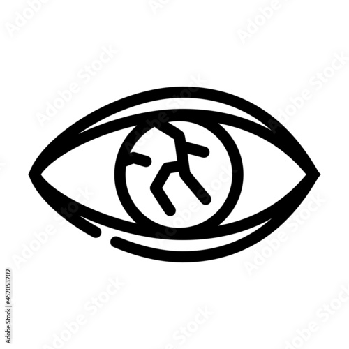 lens injury ophthalmology line icon vector. lens injury ophthalmology sign. isolated contour symbol black illustration