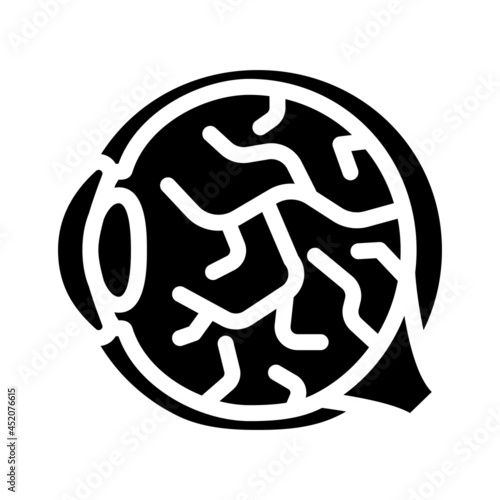 inflammation of eye ophthalmology glyph icon vector. inflammation of eye ophthalmology sign. isolated contour symbol black illustration