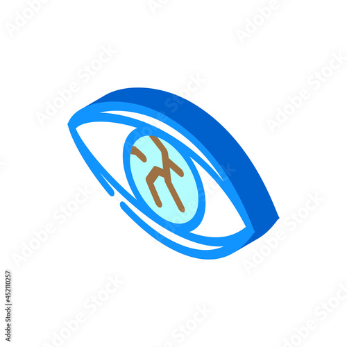 lens injury ophthalmology isometric icon vector. lens injury ophthalmology sign. isolated symbol illustration