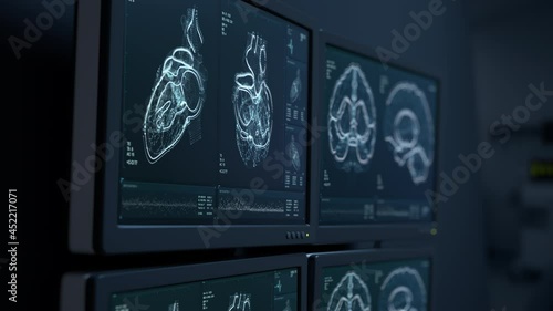 MRI heart and head scanning. Brain tumor, cancer X-ray diagnostics. Patient’s vital signs displayed on hospital screens. Disease diagnosis. CT scan Human ilness research 3D Render Medical 4K animation photo