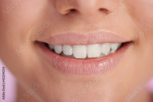 Close up of smile with teeth