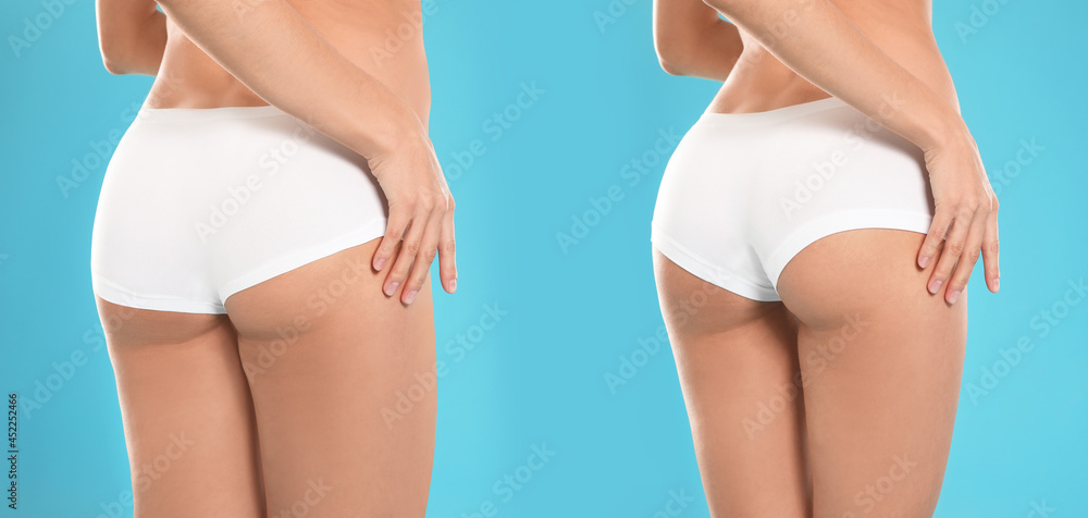 Collage with photos of woman before and after weight loss diet on light blue background, closeup. Banner design