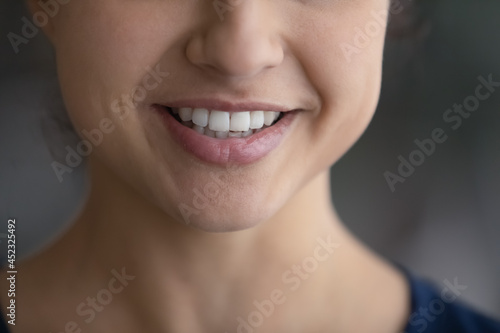 Crop close up of smiling young Indian woman show healthy white event teeth after good quality dental treatment at dentistry. Happy mixed race female talk communicate. Oralcare, diversity concept.