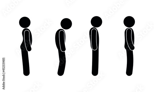 Spine curvature illustration. Healthy and sick back of a person. Posture disorders of various forms. Side view.