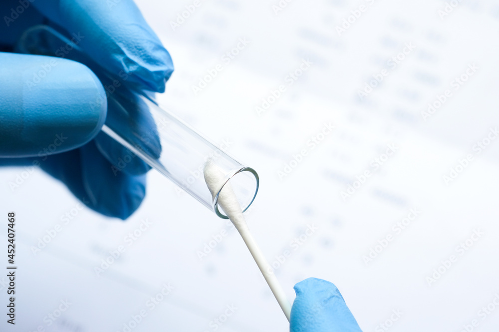 Doctor holds a COVID-19 swab collection, wears blue gloves and a PPE protective mask, and carries a test tube to collect the OP NP and test coronavirus. Doctor holds a COVID-19 swab collection, wears blue gloves and a PPE protective mask, and carries a test tube to collect the OP NP and test coronavirus.