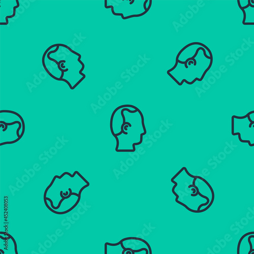 Blue line Baldness icon isolated seamless pattern on green background. Alopecia. Vector