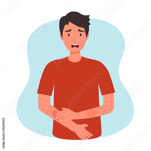 Young man scratching arm. Guy suffering from strong allergy skin itchy symptom in flat design. Red rash skin irritation.