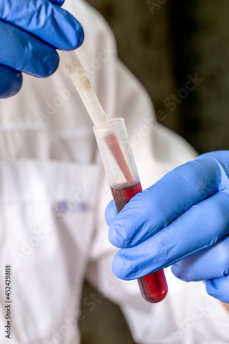 a medical worker in a white coat and blue gloves draws blood from a test tube with a pipette for analysis