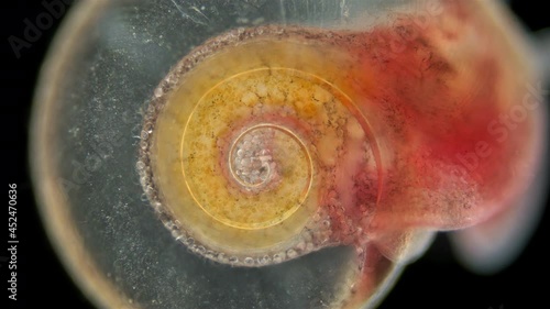 Snail Family Planorbidae under microscope, order Pulmonata. Possibly species Anisus sp. They live in fresh water and are intermediate hosts of dangerous human parasites. photo